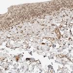 POLH Polyclonal Antibody