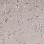 NENF Antibody in Immunohistochemistry (IHC)