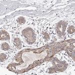 TNN Antibody in Immunohistochemistry (IHC)