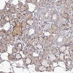 TNN Polyclonal Antibody