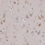 TNN Antibody in Immunohistochemistry (IHC)
