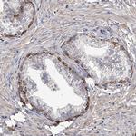TNN Antibody in Immunohistochemistry (IHC)