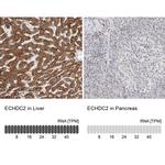 ECHDC2 Antibody