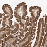 GCNT2 Antibody in Immunohistochemistry (Paraffin) (IHC (P))