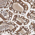 GCNT2 Antibody in Immunohistochemistry (IHC)