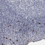 SLC25A39 Polyclonal Antibody