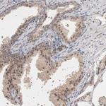 HUS1 Antibody in Immunohistochemistry (Paraffin) (IHC (P))