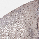 HUS1 Polyclonal Antibody