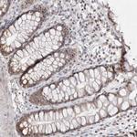 HUS1 Antibody in Immunohistochemistry (Paraffin) (IHC (P))