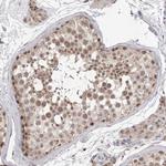 HUS1 Antibody in Immunohistochemistry (Paraffin) (IHC (P))