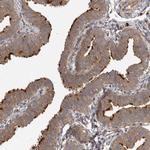 IQCK Antibody in Immunohistochemistry (IHC)