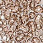 NARS2 Antibody in Immunohistochemistry (Paraffin) (IHC (P))