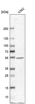 NARS2 Antibody in Western Blot (WB)