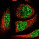 Hoxc5 Antibody in Immunocytochemistry (ICC/IF)