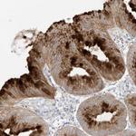 DGKQ Polyclonal Antibody