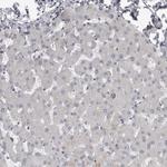 PRRX2 Polyclonal Antibody