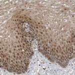 PRRX2 Antibody in Immunohistochemistry (IHC)