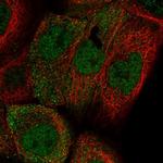 APM2 Polyclonal Antibody