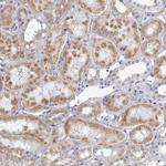 SEC11C Antibody in Immunohistochemistry (Paraffin) (IHC (P))