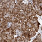 SEC11C Antibody in Immunohistochemistry (Paraffin) (IHC (P))