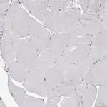 SEC11C Antibody in Immunohistochemistry (Paraffin) (IHC (P))