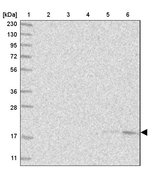 SEC11C Antibody in Western Blot (WB)