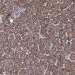 PCDH17 Antibody in Immunohistochemistry (Paraffin) (IHC (P))