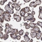 PCDH17 Antibody in Immunohistochemistry (Paraffin) (IHC (P))
