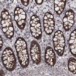 PCDH17 Antibody in Immunohistochemistry (Paraffin) (IHC (P))