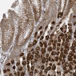 C2orf74 Antibody in Immunohistochemistry (Paraffin) (IHC (P))