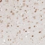 FKBP14 Antibody in Immunohistochemistry (Paraffin) (IHC (P))