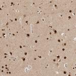 C1orf21 Antibody in Immunohistochemistry (Paraffin) (IHC (P))
