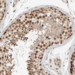C1orf21 Antibody in Immunohistochemistry (Paraffin) (IHC (P))