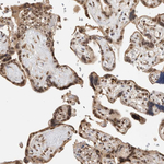 C1orf21 Antibody in Immunohistochemistry (Paraffin) (IHC (P))