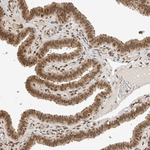 C1orf21 Antibody in Immunohistochemistry (Paraffin) (IHC (P))