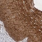 PTPDC1 Antibody in Immunohistochemistry (Paraffin) (IHC (P))