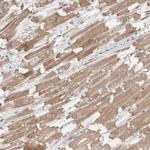 PTPDC1 Antibody in Immunohistochemistry (Paraffin) (IHC (P))
