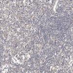 PTPDC1 Antibody in Immunohistochemistry (Paraffin) (IHC (P))