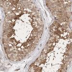 PTPDC1 Antibody in Immunohistochemistry (IHC)