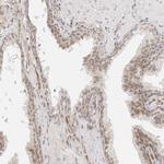 ZNF613 Antibody in Immunohistochemistry (IHC)