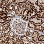 SFXN2 Antibody in Immunohistochemistry (Paraffin) (IHC (P))