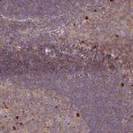 ZNF266 Antibody in Immunohistochemistry (IHC)