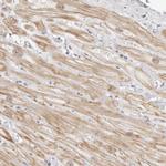 LARP7 Antibody in Immunohistochemistry (Paraffin) (IHC (P))
