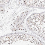 LARP7 Polyclonal Antibody