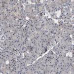 BNIP2 Antibody in Immunohistochemistry (Paraffin) (IHC (P))