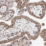SMARCC1 Antibody in Immunohistochemistry (Paraffin) (IHC (P))