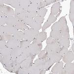 SMARCC1 Antibody in Immunohistochemistry (Paraffin) (IHC (P))