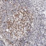 SMARCC1 Antibody in Immunohistochemistry (Paraffin) (IHC (P))