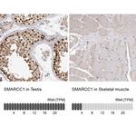 SMARCC1 Antibody in Immunohistochemistry (IHC)