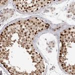 SMARCC1 Antibody in Immunohistochemistry (IHC)